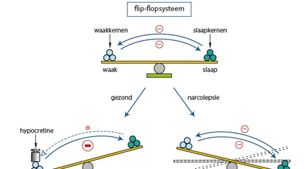 Oorzaken en behandeling van hypersomnolentie 