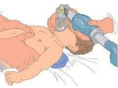 Acute opvang van de pasgeborene