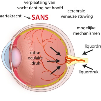 SANS