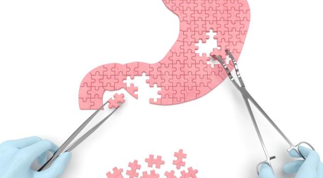 Geneesmiddelgebruik bij obesitas en na bariatrische chirurgie