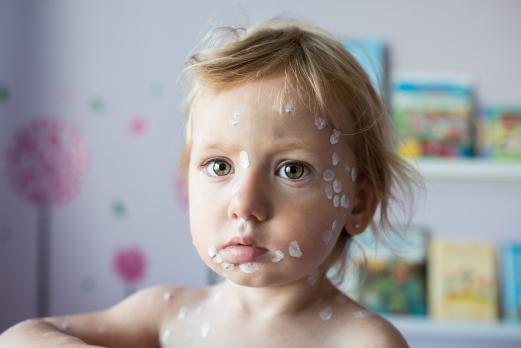 Kinderziekten