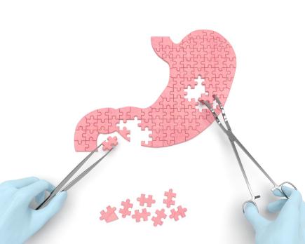 Geneesmiddelgebruik bij obesitas en na bariatrische chirurgie