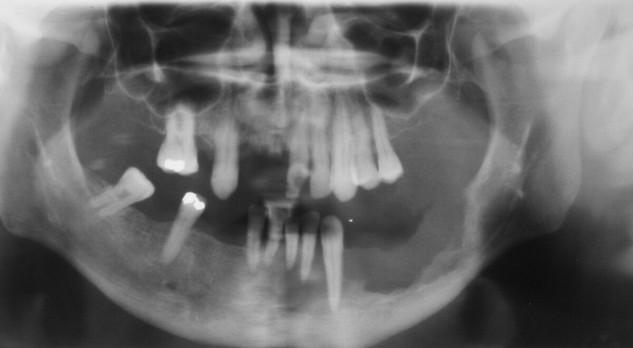 Niet-tandheelkundige toepassingen van cone-beam CT 