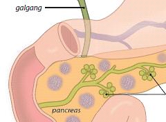 Diabetes type 2, meer dan suikerziekte