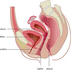 Verminderde urine-uitscheiding