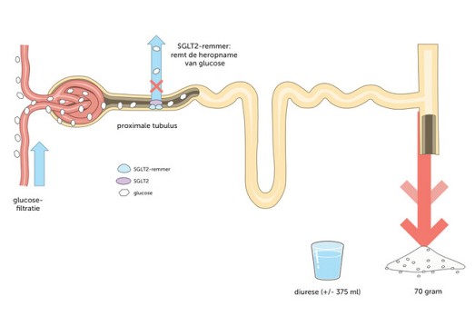 SGLT2-remmers bij diabetes mellitus type 2, hartfalen en nierziekte