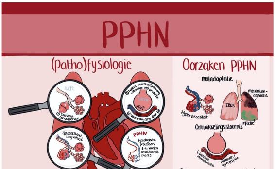 Infographic PPHN