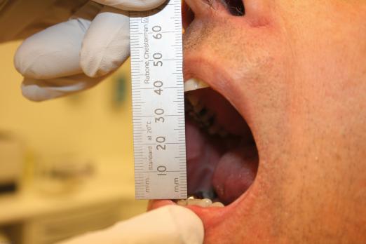 Temporomandibulaire disfunctie (AF, BD, MT)