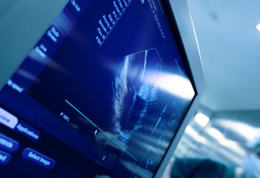 Ileo-ileale invaginatie: met moderne echografische technieken vaker gezien als toevalsbevinding