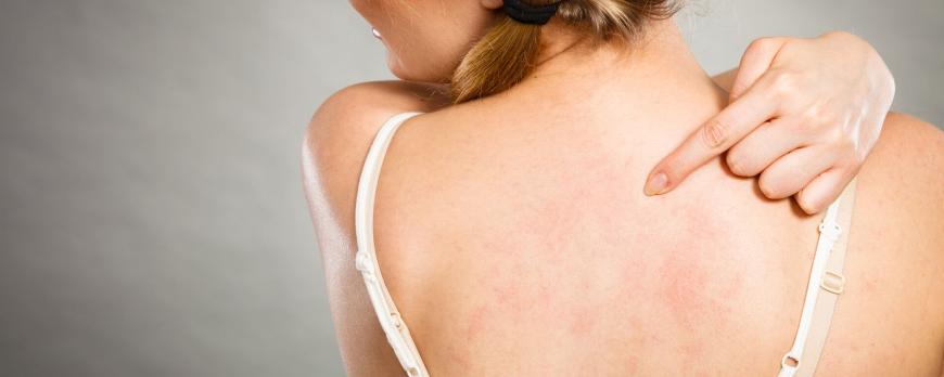 Immuunstoornissen deel 2