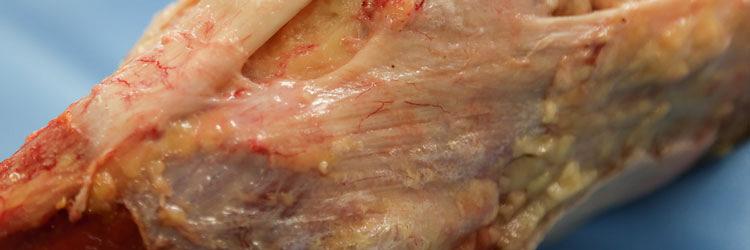 Zijn de obertesten valide voor het vaststellen van de mobiliteit van de iliotibiale band?