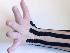 Lymftaping als complementaire behandelmethode bij oedeem na weefselschade