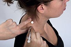 Dystonie in de dagelijkse praktijk