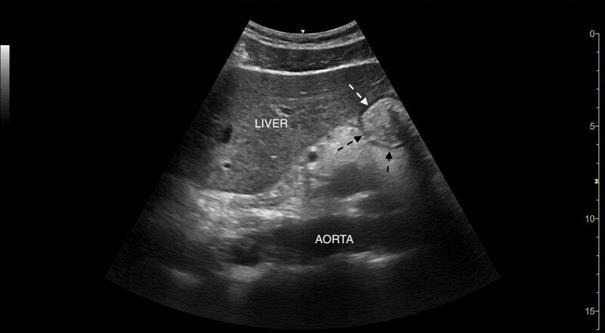 Praktische voorbeelden van echografie