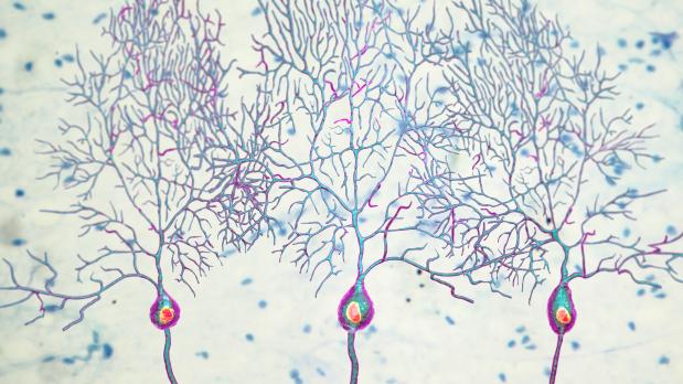 Epilepsie en het EEG van het cerebellum