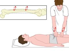 Diagnostische tekens bij een chronische liesblessure