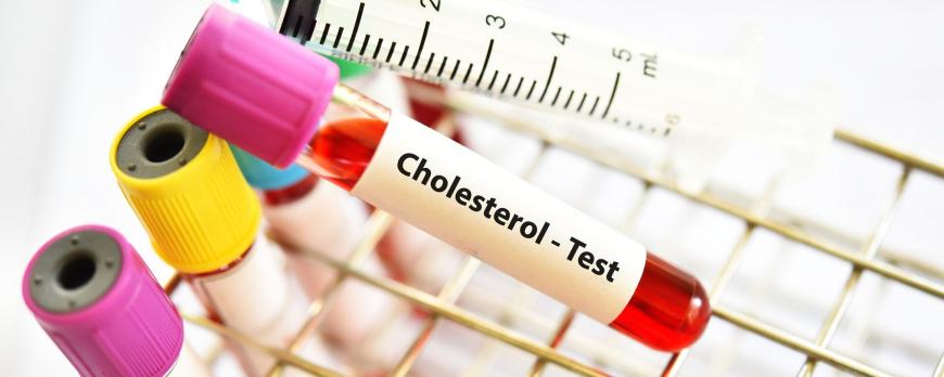 Cholesterolverlaging anno 2025