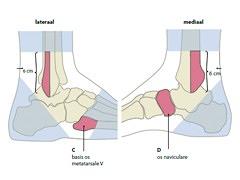 Ottawa ankle rules in de fysiotherapeutische praktijk