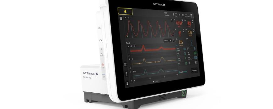 Gebruik van carotisechografie om vullingsresponsiviteit te voorspellen