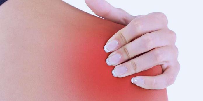 Schouderklachten deel 1