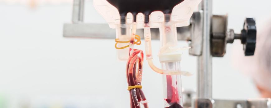 Transfusiegrenzen in ECMO