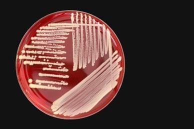 Antibioticaresistentie