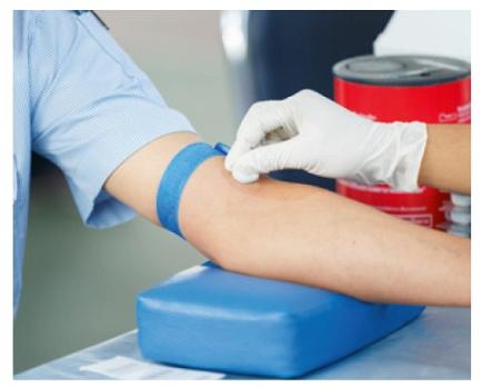Hyperprolactinemie bij antipsychoticumgebruik