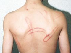 Gevallen of geslagen?