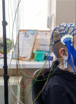 Epilepsie bij kinderen