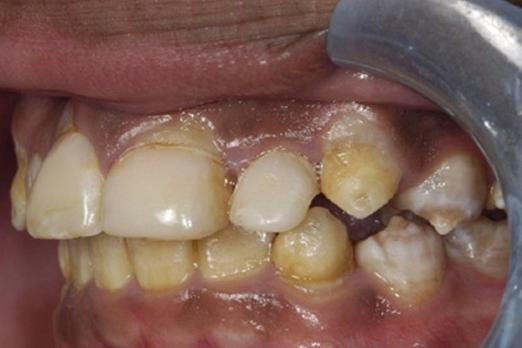 Osteogenesis imperfecta: een multidisciplinaire aangelegenheid in diagnostiek en behandeling
