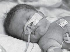 Patiëntveiligheid op een kinder- of neonatologie afdeling