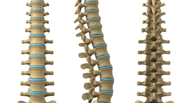 Spinaal dysrafisme