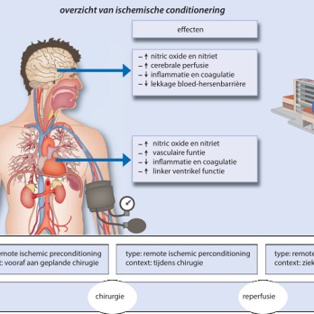 Perioperatieve ischemische conditionering 