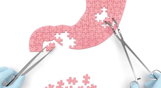 Geneesmiddelgebruik bij obesitas en na bariatrische chirurgie