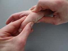 De fysiotherapeutische beoordeling van gesloten vingertraumata