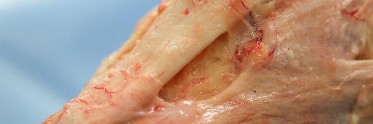 Toegepaste bindweefselfysiologie