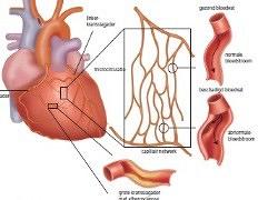 Cardiologie voor vrouwen is sterk in beweging
