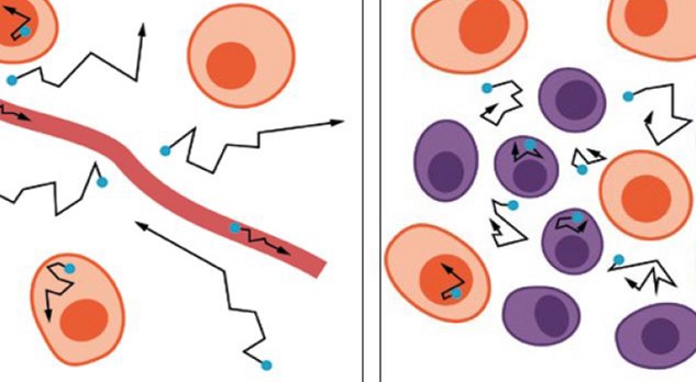 Diffusiegewogen MRI in de oncologie 