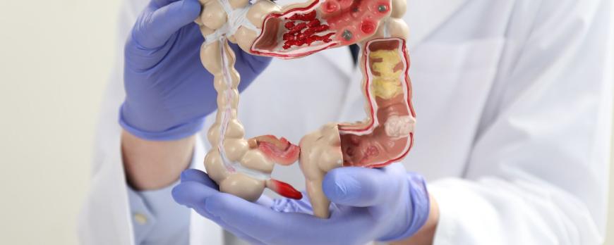 Bloedserieus: de acute opvang bij een bovenste tractus-digestivusbloeding