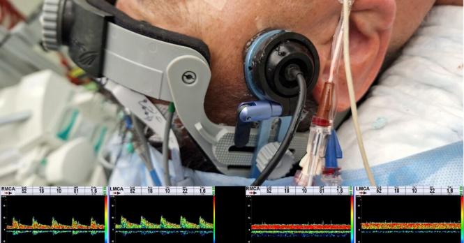 Preoperatieve screening en neuromonitoring bij openhartoperaties