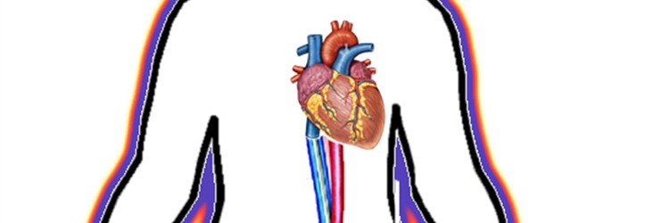 Extracorporale cardiopulmonale resuscitatie (ECPR) 