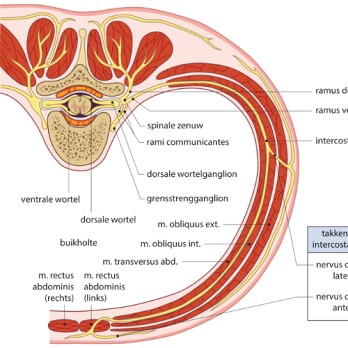 Het anterior cutaneous nerve entrapment syndrome (ACNES) 