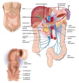 Naadlekkage na colorectale operatieve ingreep