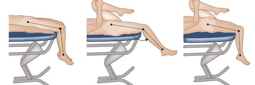 Welke interventies zijn zinvol voor kinderen met de ziekte van Osgood-Schlatter?