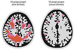 Alcohol en jongeren: laat je niet flessen!