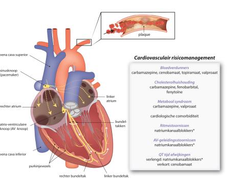 Cardiovasculaire complicaties van de behandeling van epilepsie met anti-aanvalsmedicatie