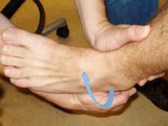 De enkel is zelden 'enkel'