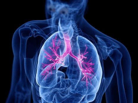 COPD