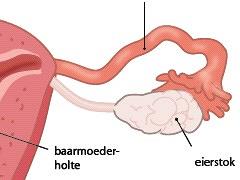 Casus ovariumcarcinoom