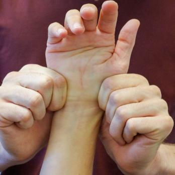 Neurodynamische behandeling van een 44-jarige patiënte met een carpaaltunnelsyndroom (VI)